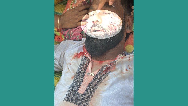 হোসেনপুরে দুই চেয়ারম্যান প্রার্থীর সমর্থকদের সংঘর্ষ, আহত অন্তত ১৫